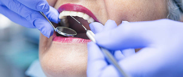 Best Dental Abscess Treatment in Warrensville Heights, OH
